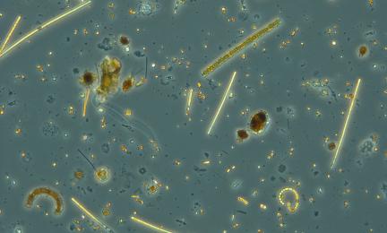 Eri muotoisia kasviplanktoneita ja ripsieläimiä mikroskoopissa. 