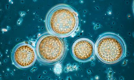 Ruskeita ja pyöreitä kasviplanktoneita mikroskoopissa. 