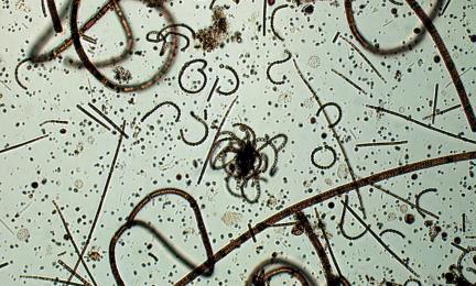 Vihertävää levää rantavedessä.